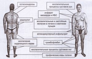 апитерапия